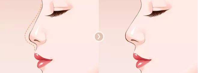 /uploads/picture/20190824/d821eceb29523476a98651865bd22b0e.jpg