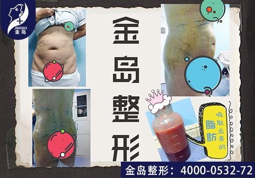 /uploads/picture/20190821/daaa0bb9fef9518cb094282add9c4926.jpg