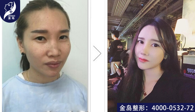 /uploads/picture/20190805/d77a3c7804eb178e4cbda06b386e1399.jpg