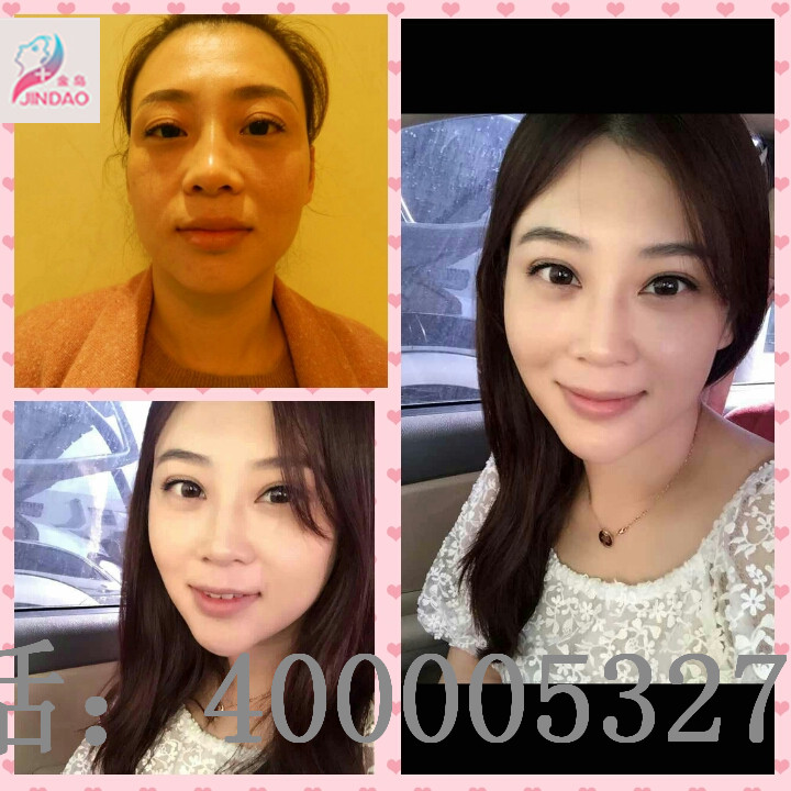 /uploads/picture/20190805/8b1cd6023344aab2cc47005a602dd06a.jpg