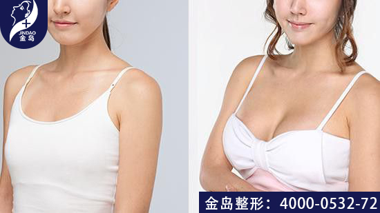 /uploads/picture/20190725/5b842a360f94f54e2c1912d8b8e0a6c5.jpg