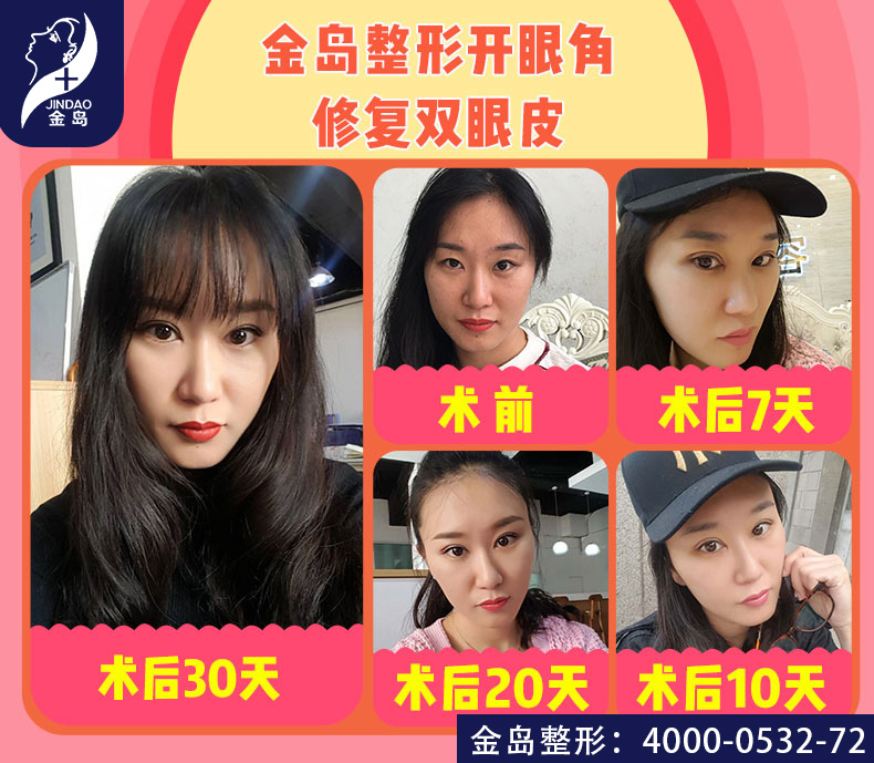 /uploads/picture/20190724/bee15e831a8969e0000feb2ac4d3cfb1.jpg