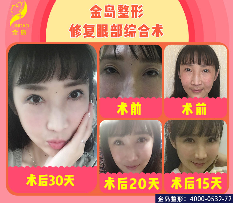 /uploads/picture/20190723/1f2ecc221bbaf6895cea46f4f448b6ae.jpg