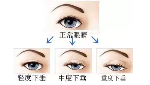 /uploads/picture/20190723/4062462fd50012795da2e172be200872.png