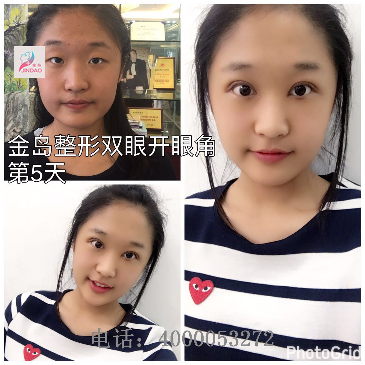 /uploads/picture/20190719/b09497b9eb71ba5ba5cddc36d45e58b4.jpg
