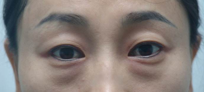 /uploads/picture/20190712/0b23179351e2685d9c119784d36aef5a.jpg