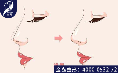 /uploads/picture/20190704/952cc8344674aab25facd7df567c6ba0.jpg