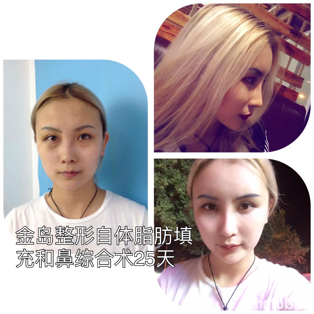 /uploads/picture/20171009/c10880dacbc231ab934235a15d84ce96.jpg